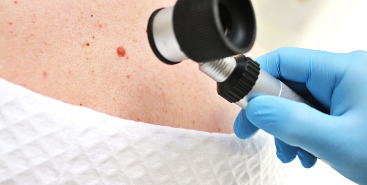 Zmiana skórna – kiedy wymaga pogłębionej diagnostyki?